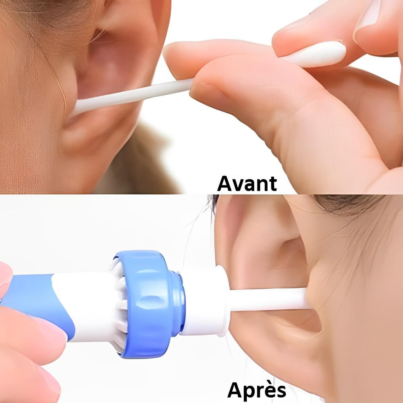 Aspirateur Pour Nettoyer Les Oreilles