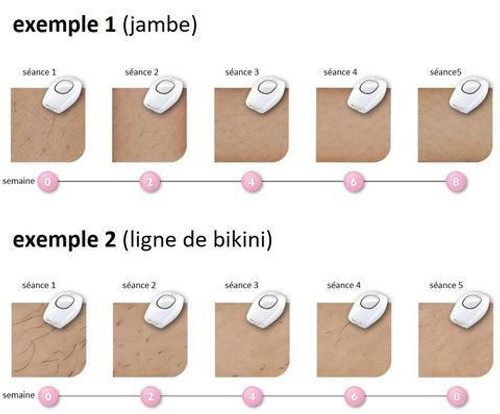 Hair-Off Appareil d'épilation définitive au laser